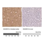 Merck Anti-KIAA0513 antibody produced in rabbit
