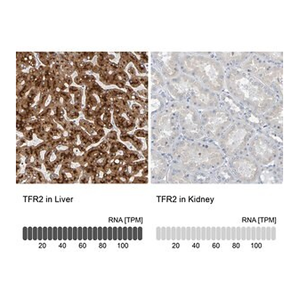 Merck Anti-TFR2 antibody produced in rabbit