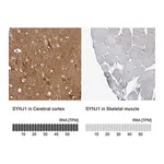 Merck Anti-SYNJ1 antibody produced in rabbit