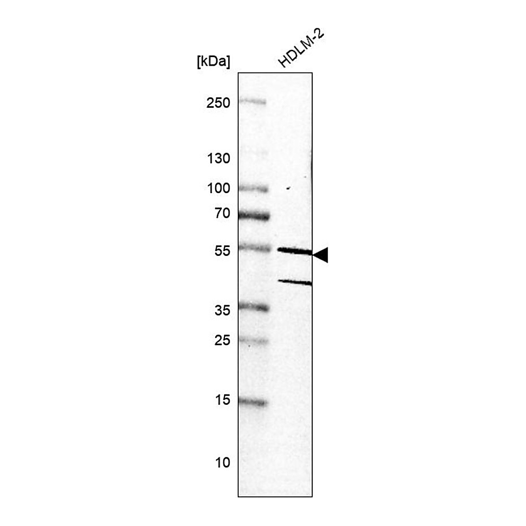 Merck Anti-RIOX2 antibody produced in rabbit