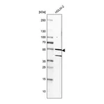 Merck Anti-RIOX2 antibody produced in rabbit