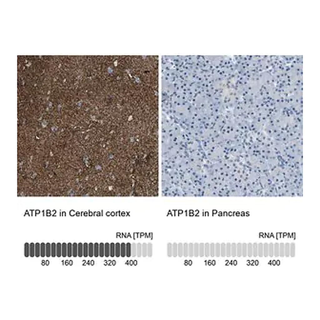 Merck Anti-ATP1B2 antibody produced in rabbit
