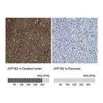 Merck Anti-ATP1B2 antibody produced in rabbit
