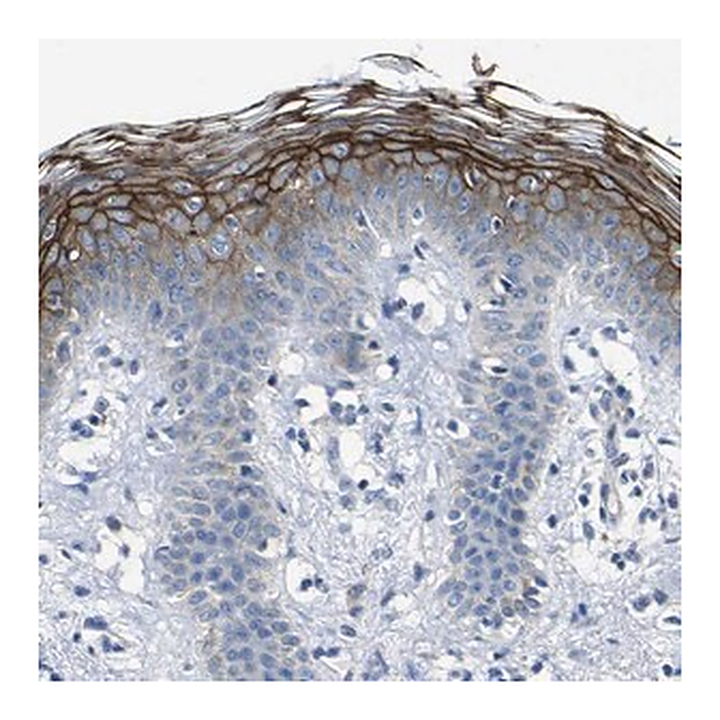 Merck Anti-DSC1 antibody produced in rabbit