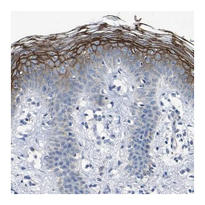 Merck Anti-DSC1 antibody produced in rabbit