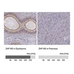 Merck Anti-ZNF185 antibody produced in rabbit