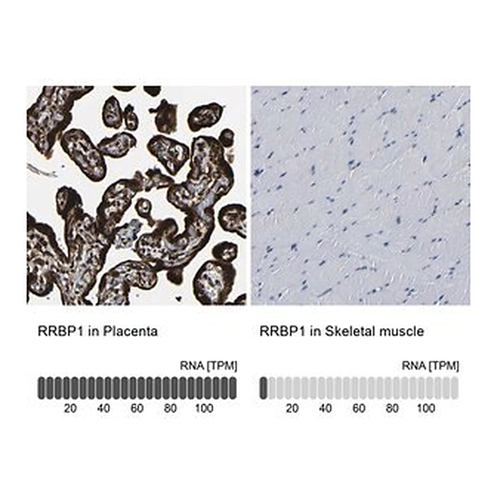 Merck Anti-RRBP1 antibody produced in rabbit