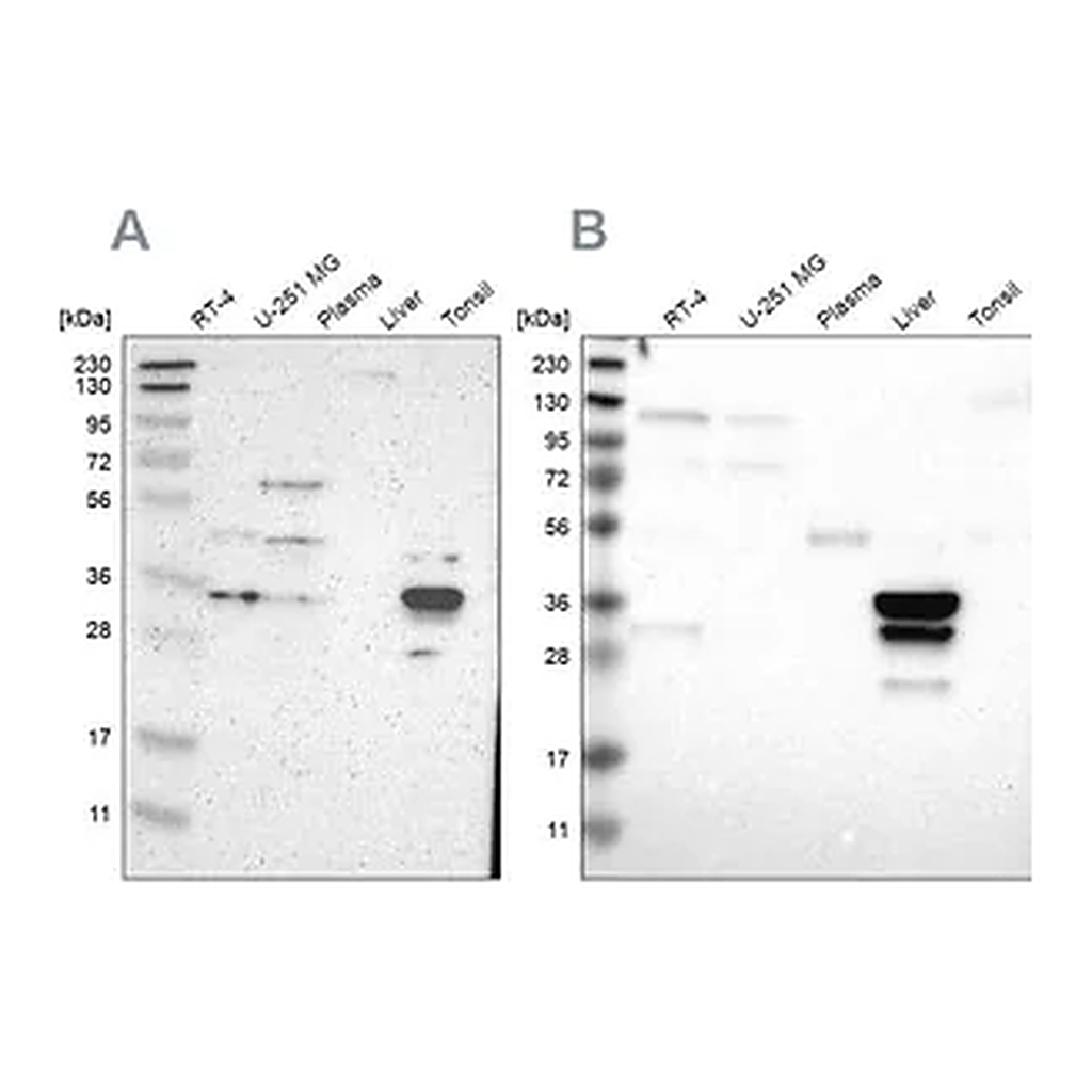 Merck Anti-PHYH antibody produced in rabbit
