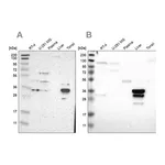 Merck Anti-PHYH antibody produced in rabbit