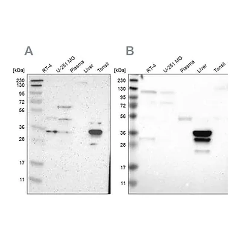 Merck Anti-PHYH antibody produced in rabbit