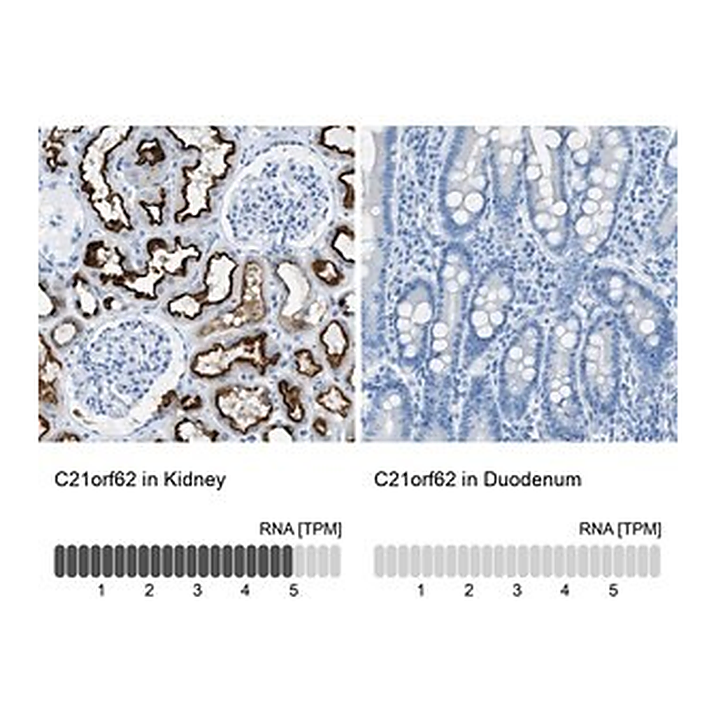 Merck Anti-C21orf62 antibody produced in rabbit