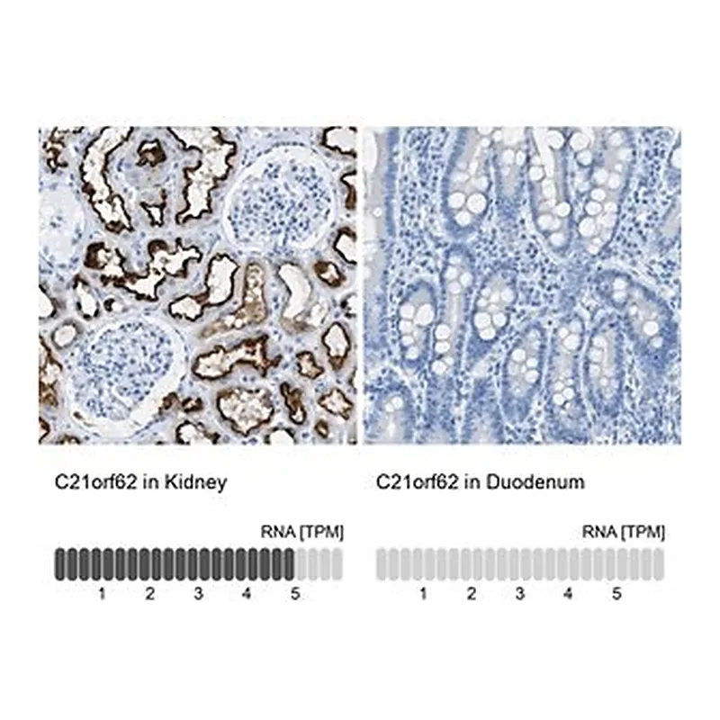 Merck Anti-C21orf62 antibody produced in rabbit