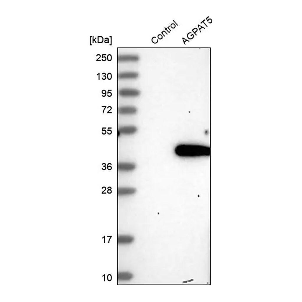 Merck Anti-AGPAT5 antibody produced in rabbit