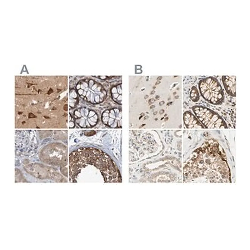 Merck Anti-LRRC47 antibody produced in rabbit