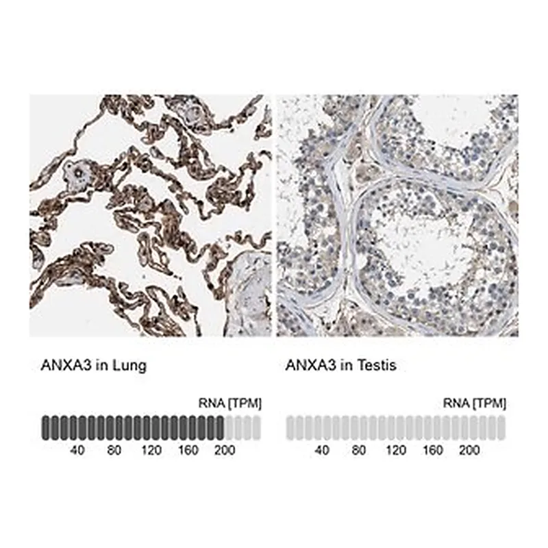 Merck Anti-ANXA3 antibody produced in rabbit