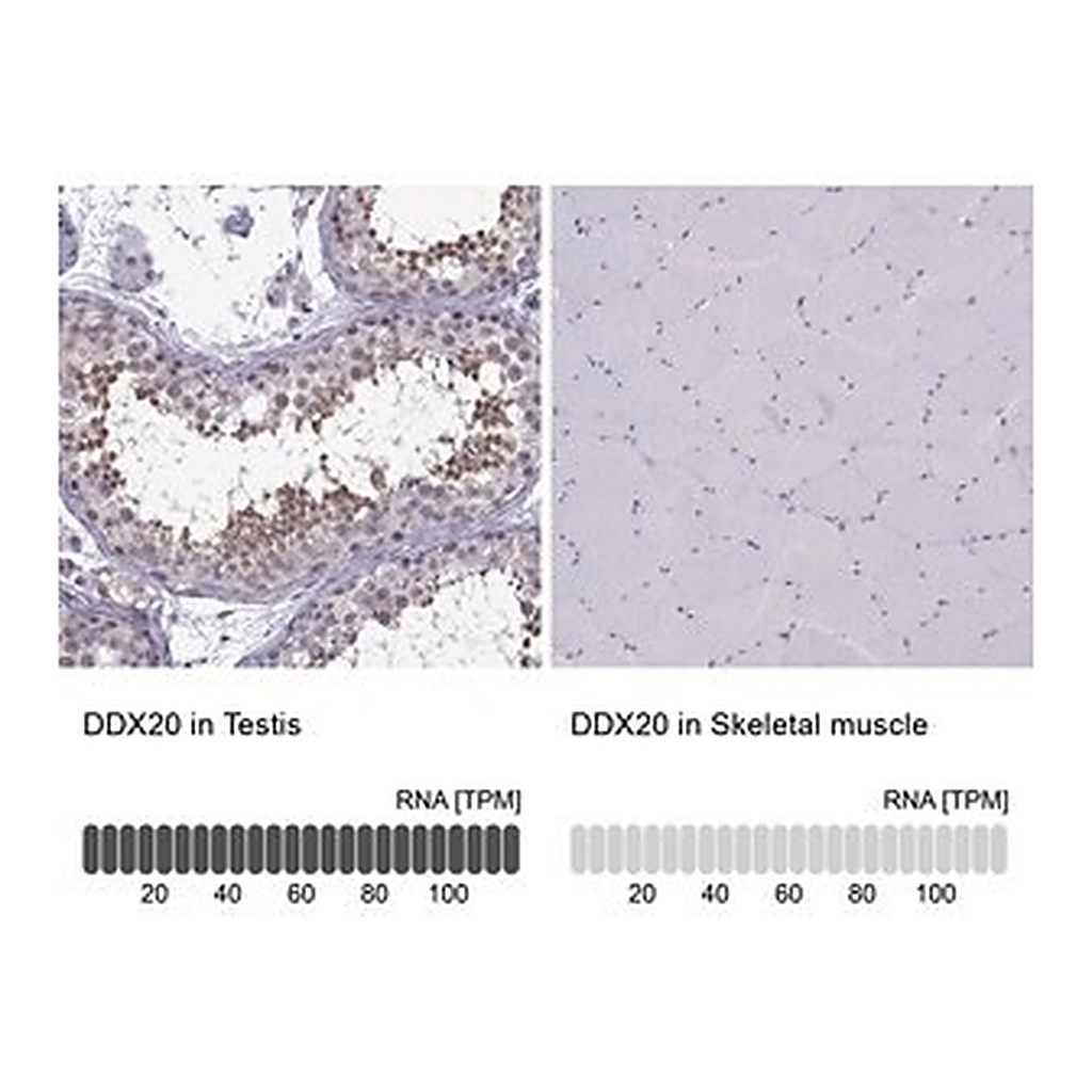 Merck Anti-DDX20 antibody produced in rabbit