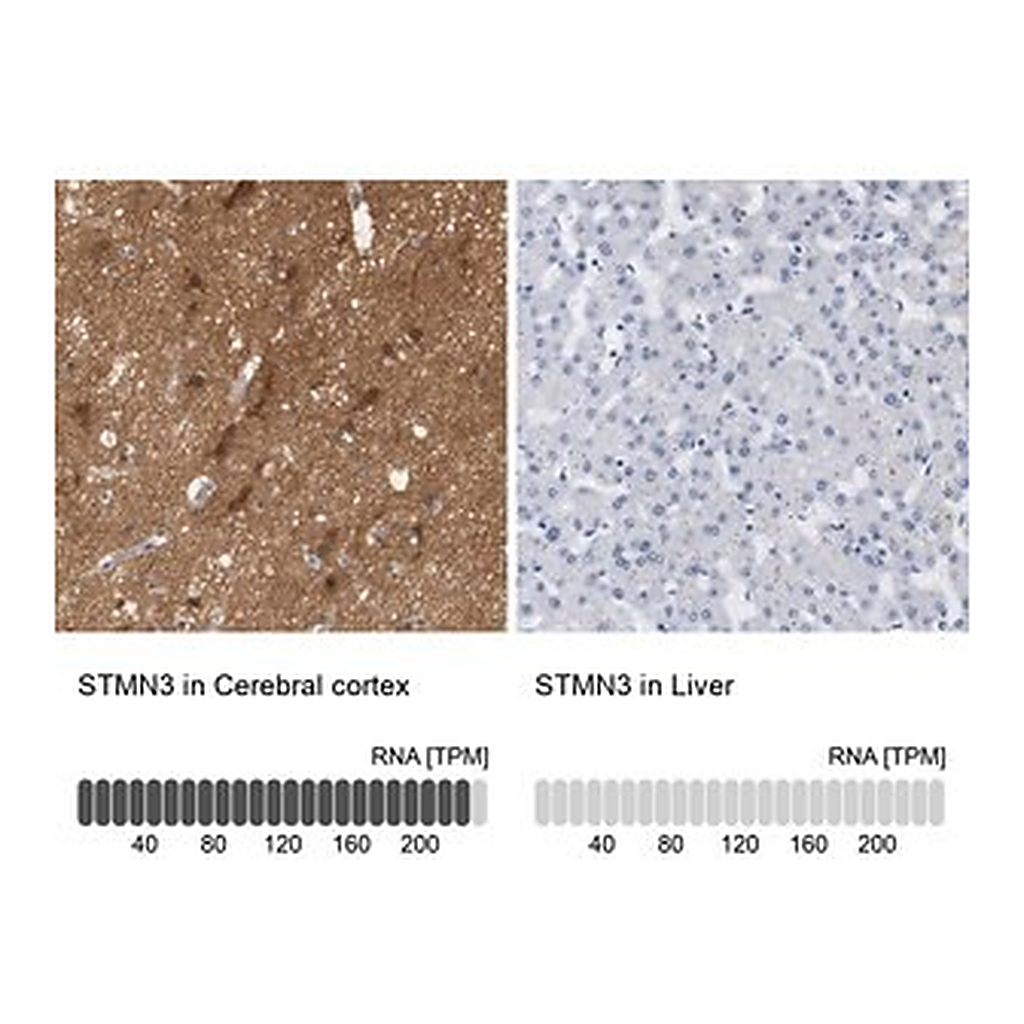 Merck Anti-STMN3 antibody produced in rabbit
