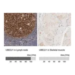 Merck Anti-UBE2J1 antibody produced in rabbit