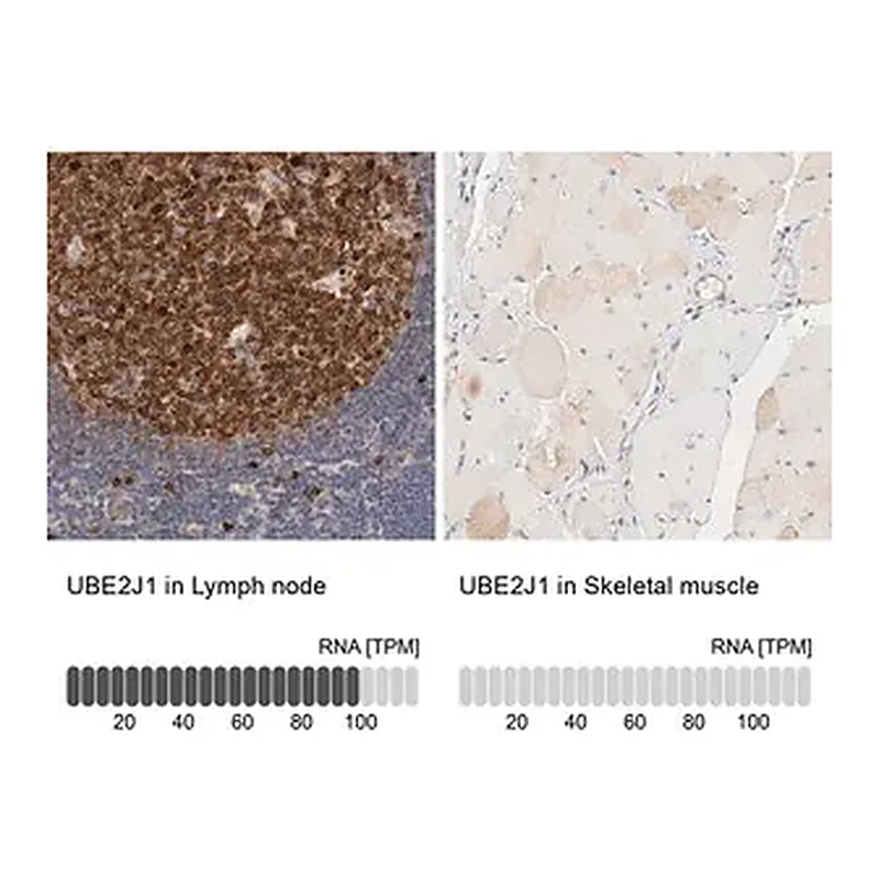 Merck Anti-UBE2J1 antibody produced in rabbit