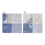Merck Anti-B4GALNT1 antibody produced in rabbit