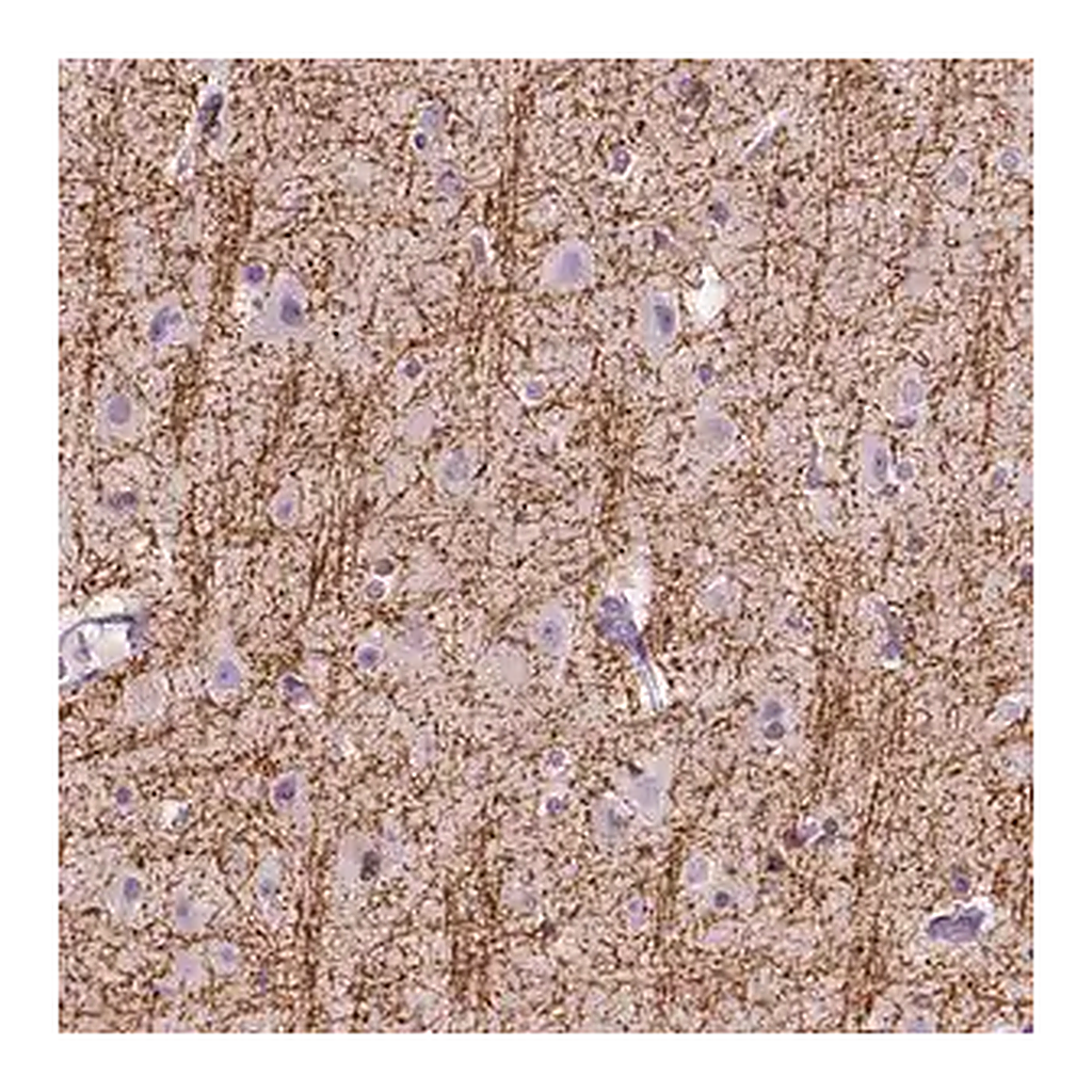 Merck Anti-SIRT2 antibody produced in rabbit