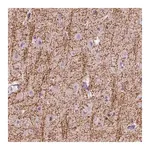 Merck Anti-SIRT2 antibody produced in rabbit