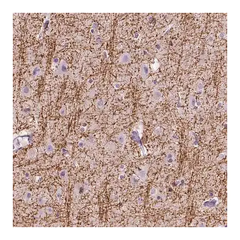 Merck Anti-SIRT2 antibody produced in rabbit