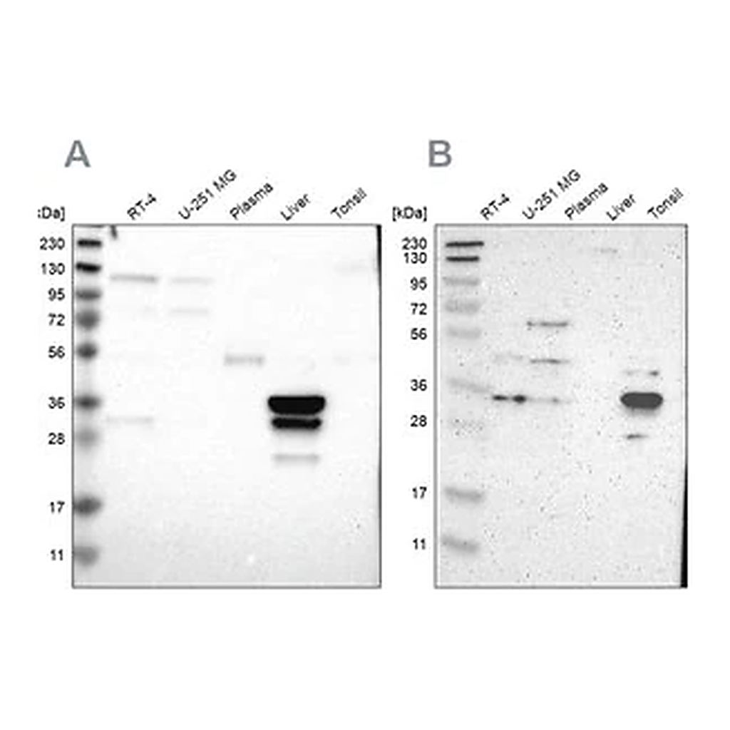 Merck Anti-PHYH antibody produced in rabbit