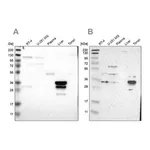 Merck Anti-PHYH antibody produced in rabbit