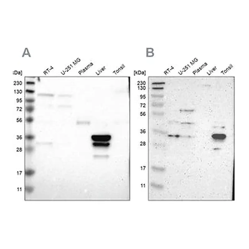 Merck Anti-PHYH antibody produced in rabbit