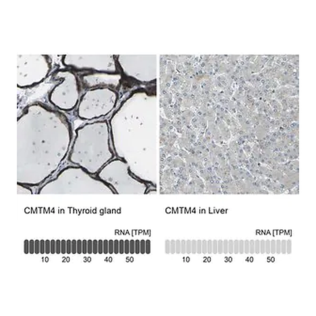 Merck Anti-CMTM4 antibody produced in rabbit