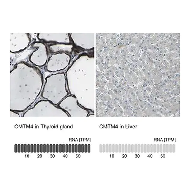 Merck Anti-CMTM4 antibody produced in rabbit