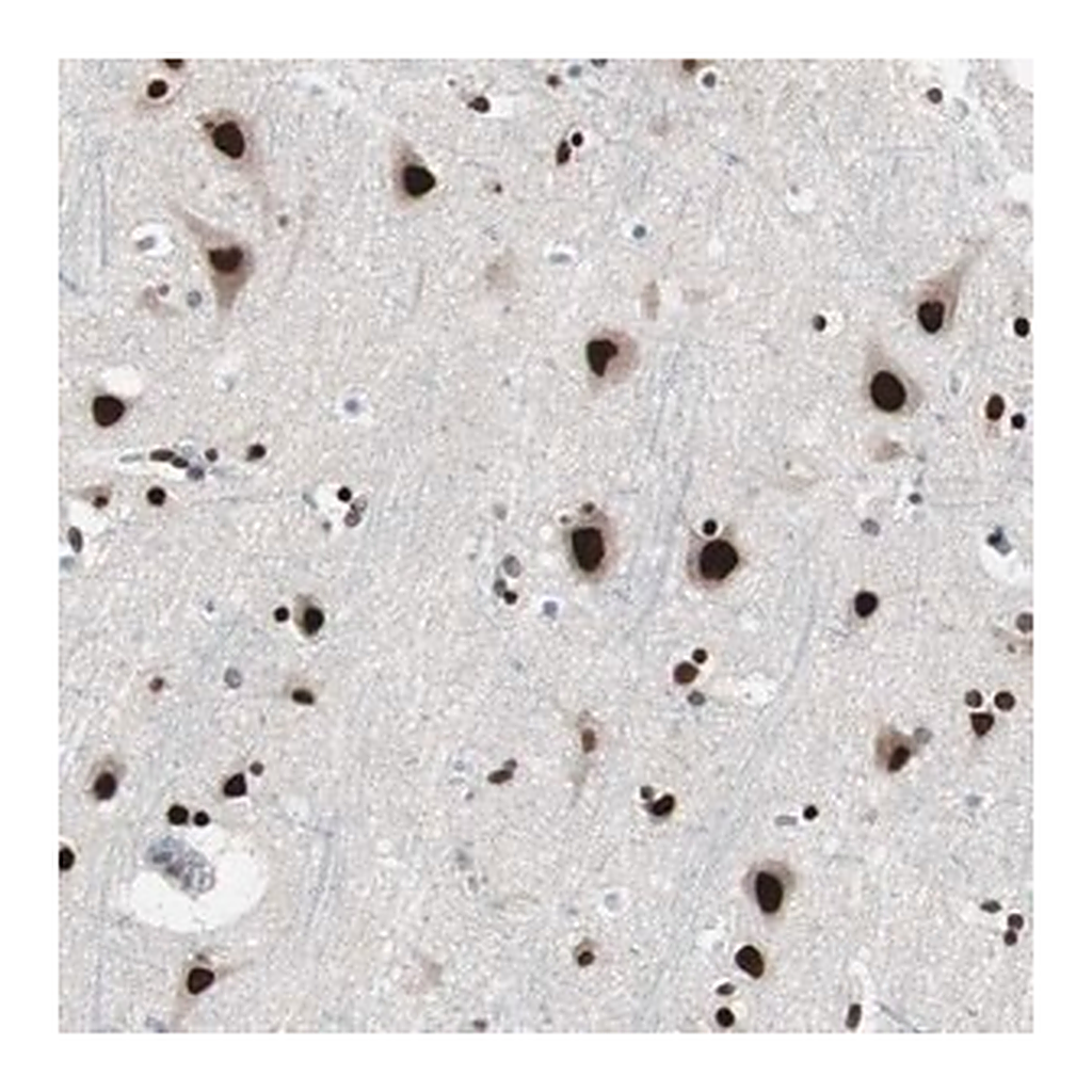 Merck Anti-POGZ antibody produced in rabbit