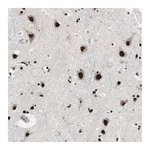 Merck Anti-POGZ antibody produced in rabbit