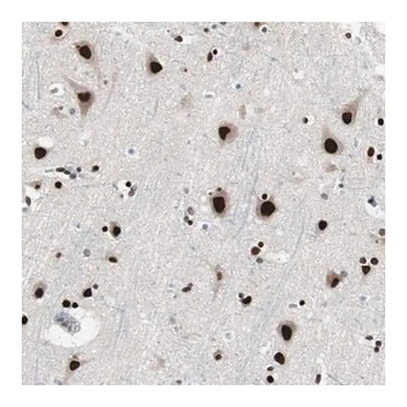 Merck Anti-POGZ antibody produced in rabbit