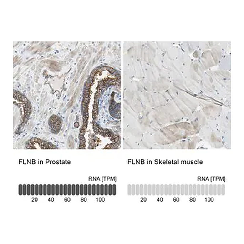 Merck Anti-FLNB antibody produced in rabbit