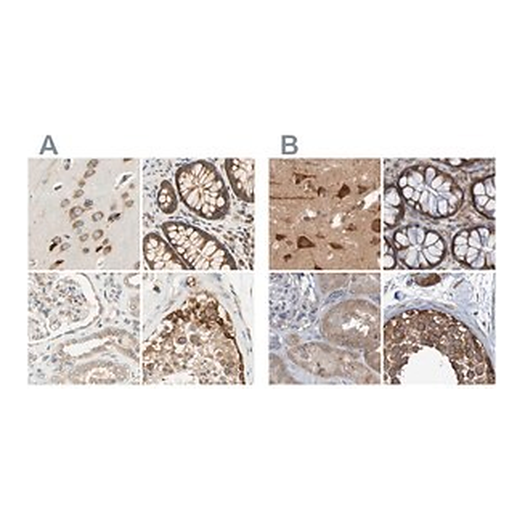 Merck Anti-LRRC47 antibody produced in rabbit
