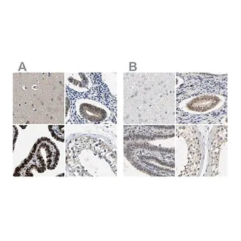 Merck Anti-PGR antibody produced in rabbit