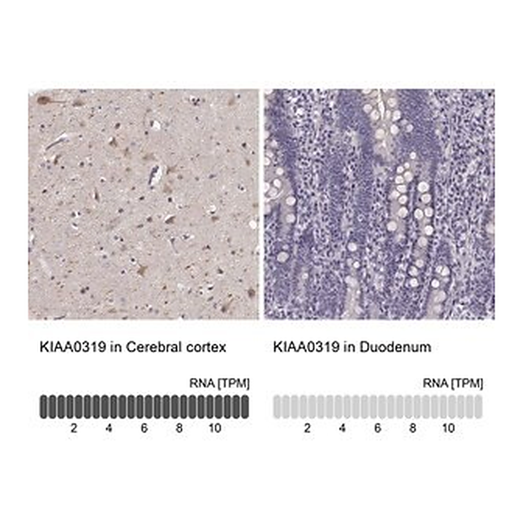 Merck Anti-KIAA0319 antibody produced in rabbit