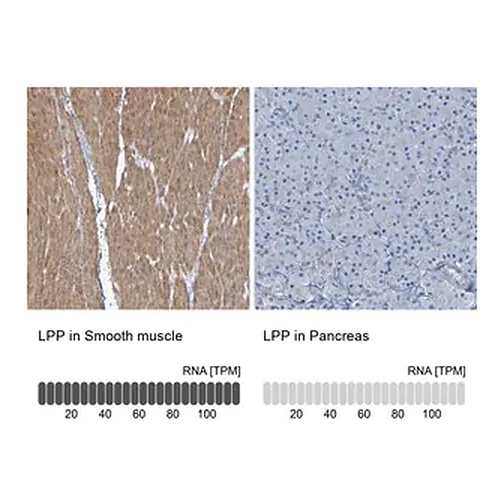 Merck Anti-LPP antibody produced in rabbit