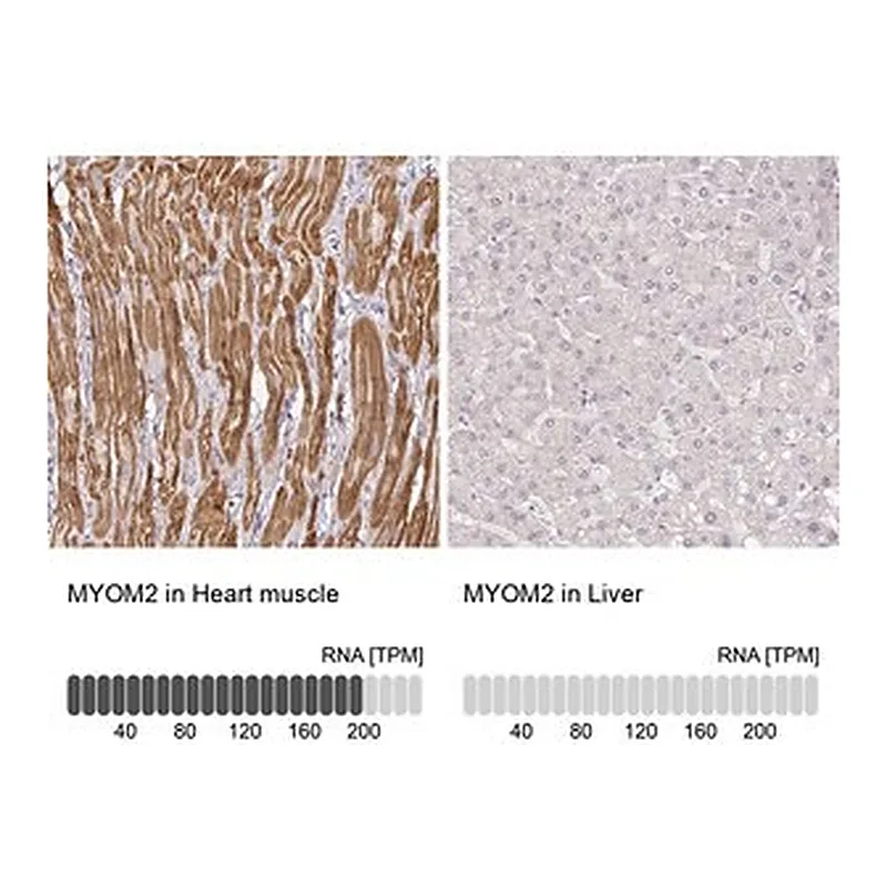 Merck Anti-MYOM2 antibody produced in rabbit