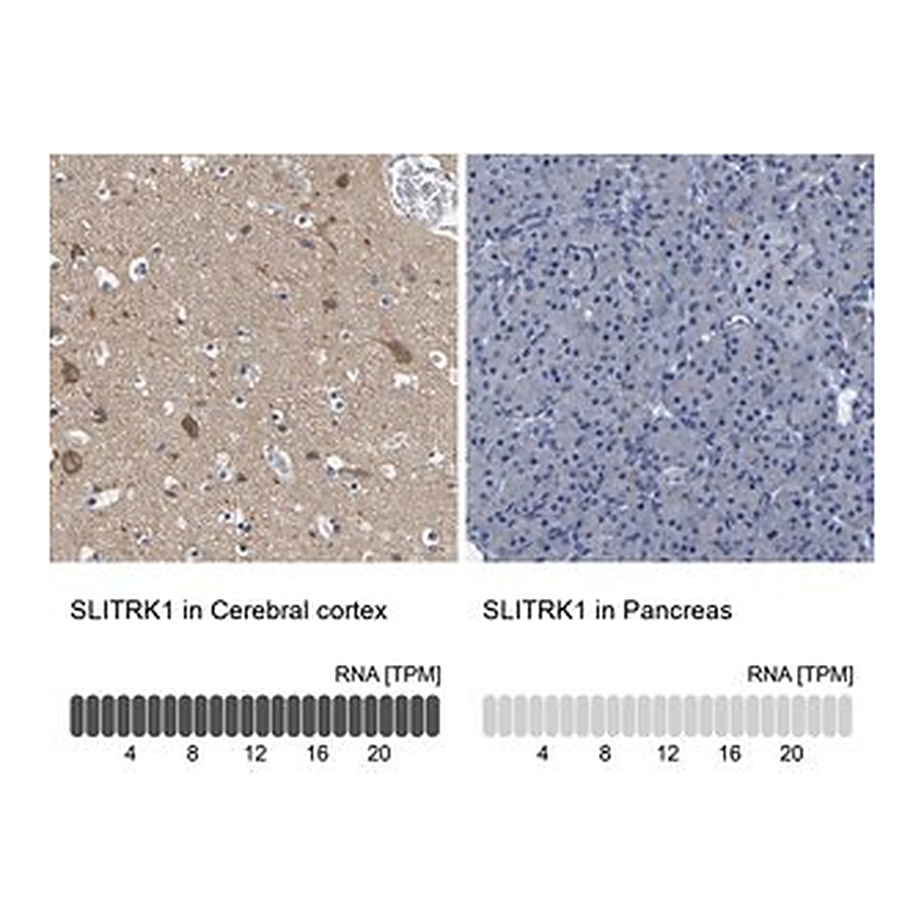 Merck Anti-SLITRK1 antibody produced in rabbit