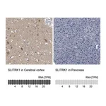 Merck Anti-SLITRK1 antibody produced in rabbit