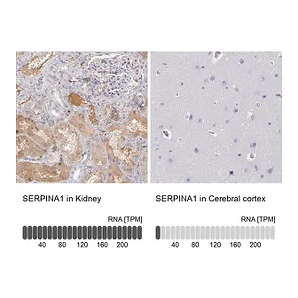 Merck Anti-SERPINA1 antibody produced in rabbit