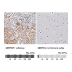 Merck Anti-SERPINA1 antibody produced in rabbit