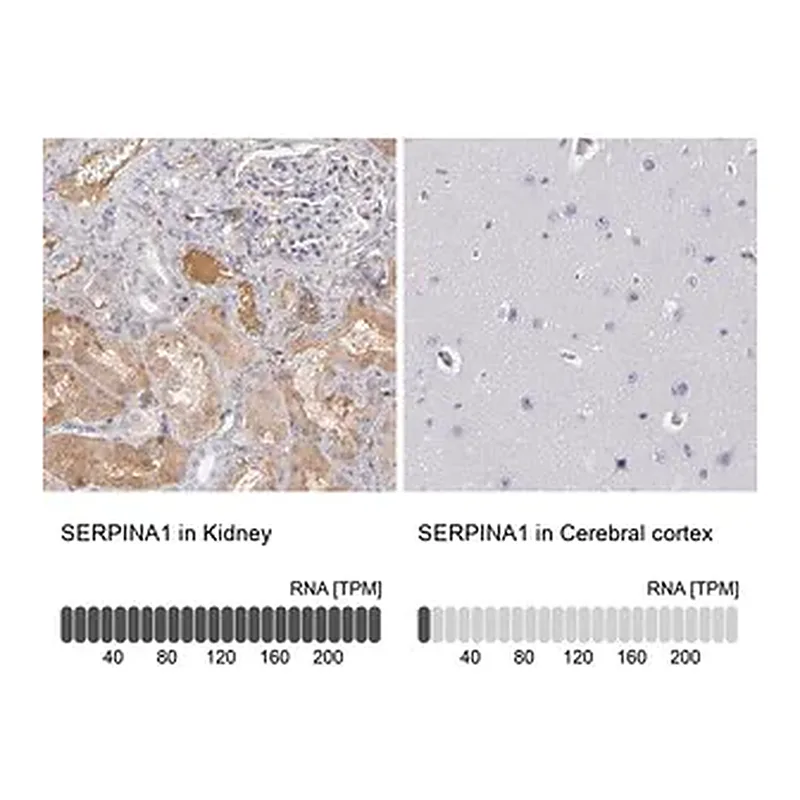 Merck Anti-SERPINA1 antibody produced in rabbit