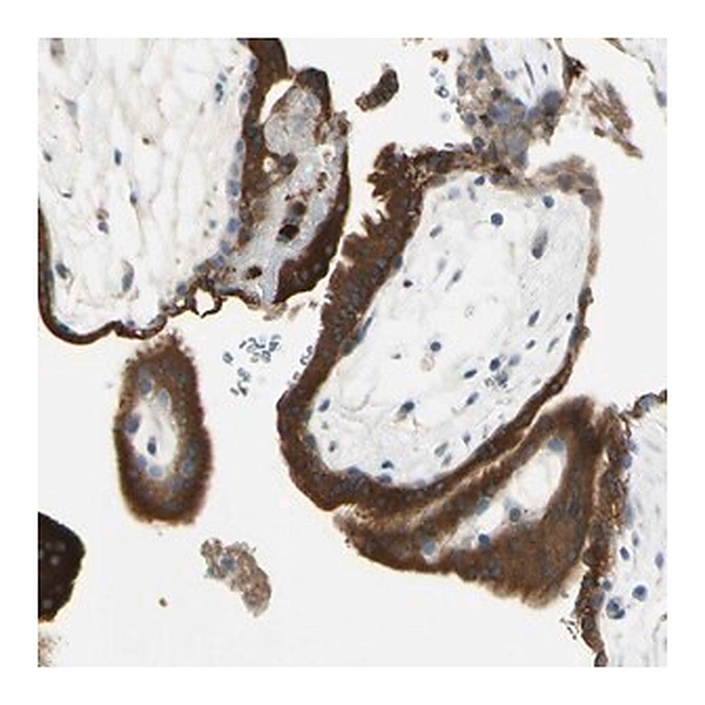 Merck Anti-ANGPTL1 antibody produced in rabbit