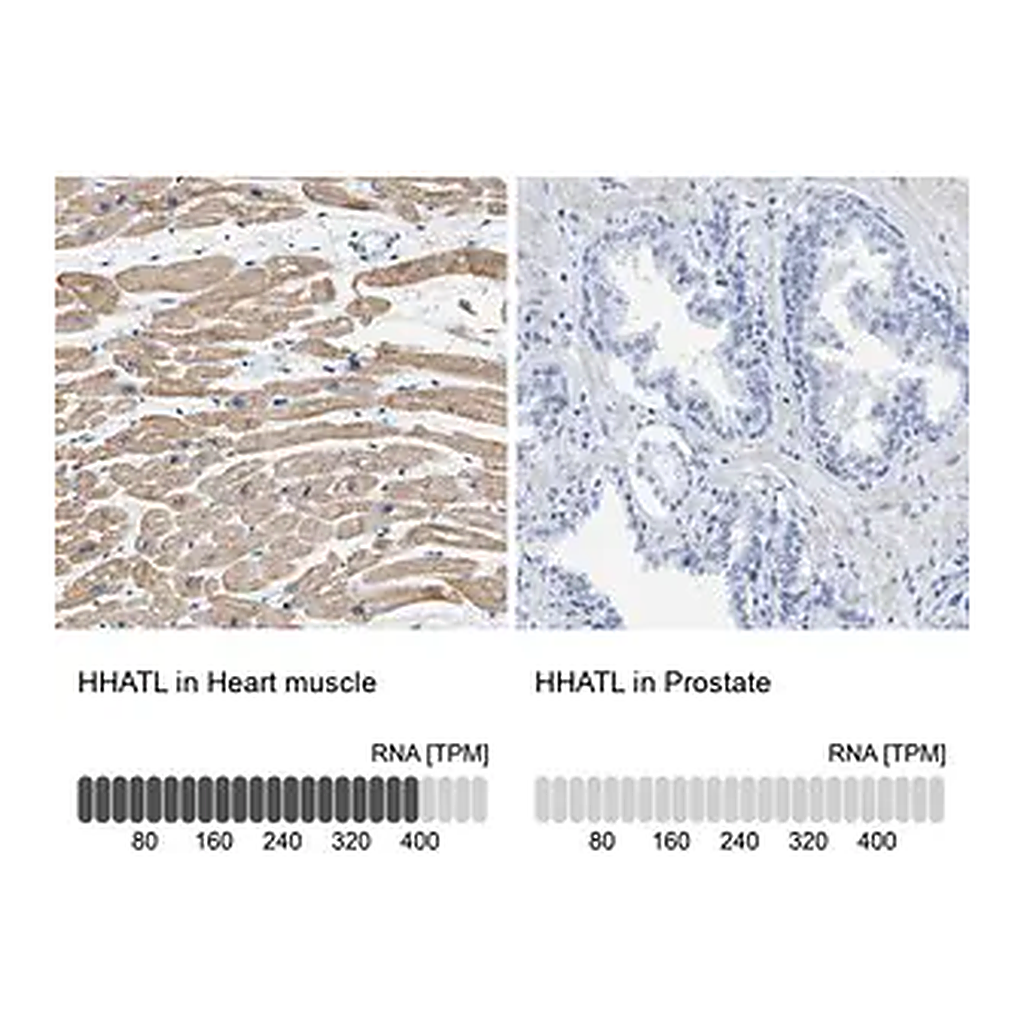 Merck Anti-HHATL antibody produced in rabbit