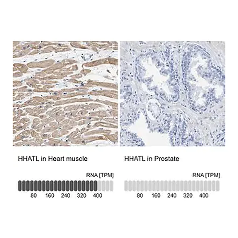 Merck Anti-HHATL antibody produced in rabbit