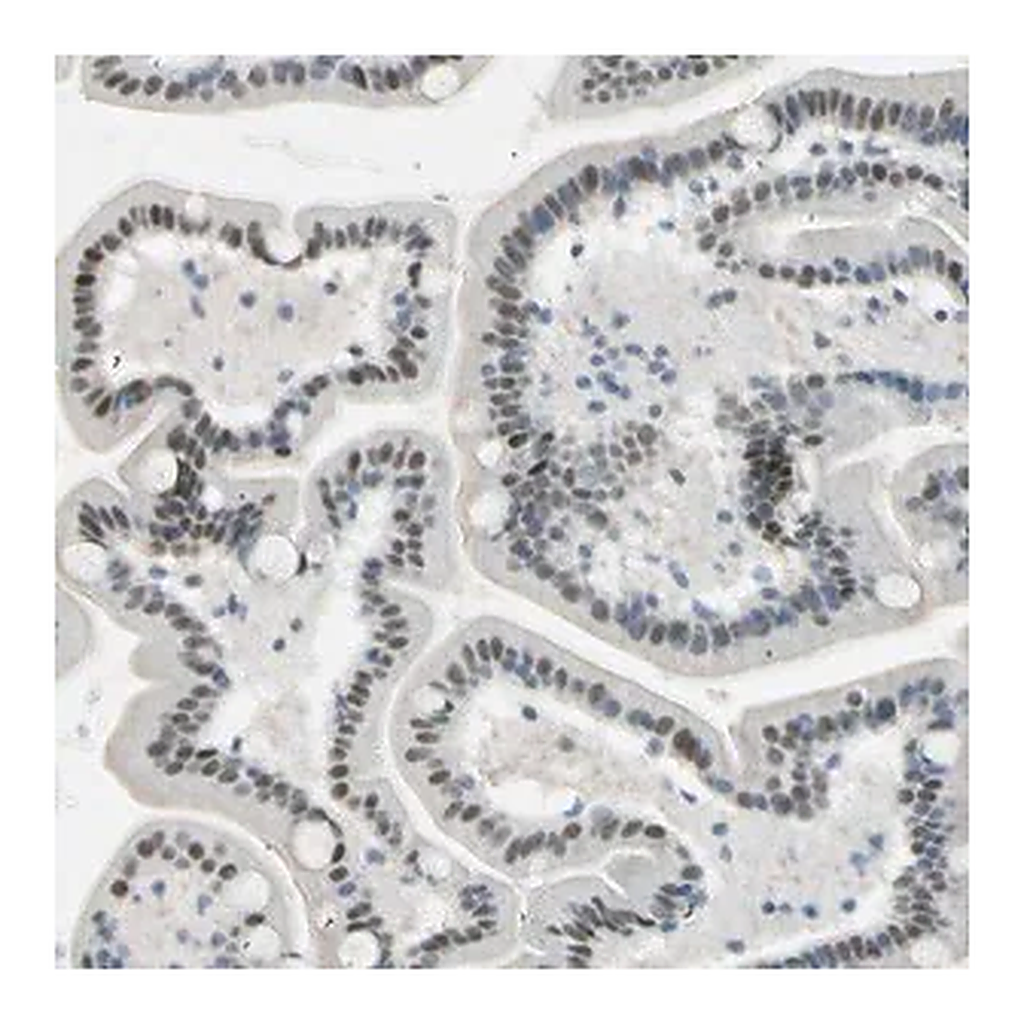 Merck Anti-RNF43 antibody produced in rabbit